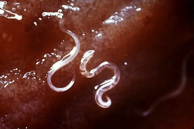 Cute lil' hookworms hanging onto someone's lucky intestines